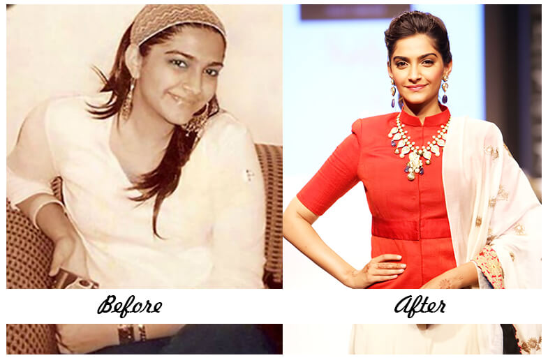 Sonam Kapoor Before and after Sonam Kapoor Before and after