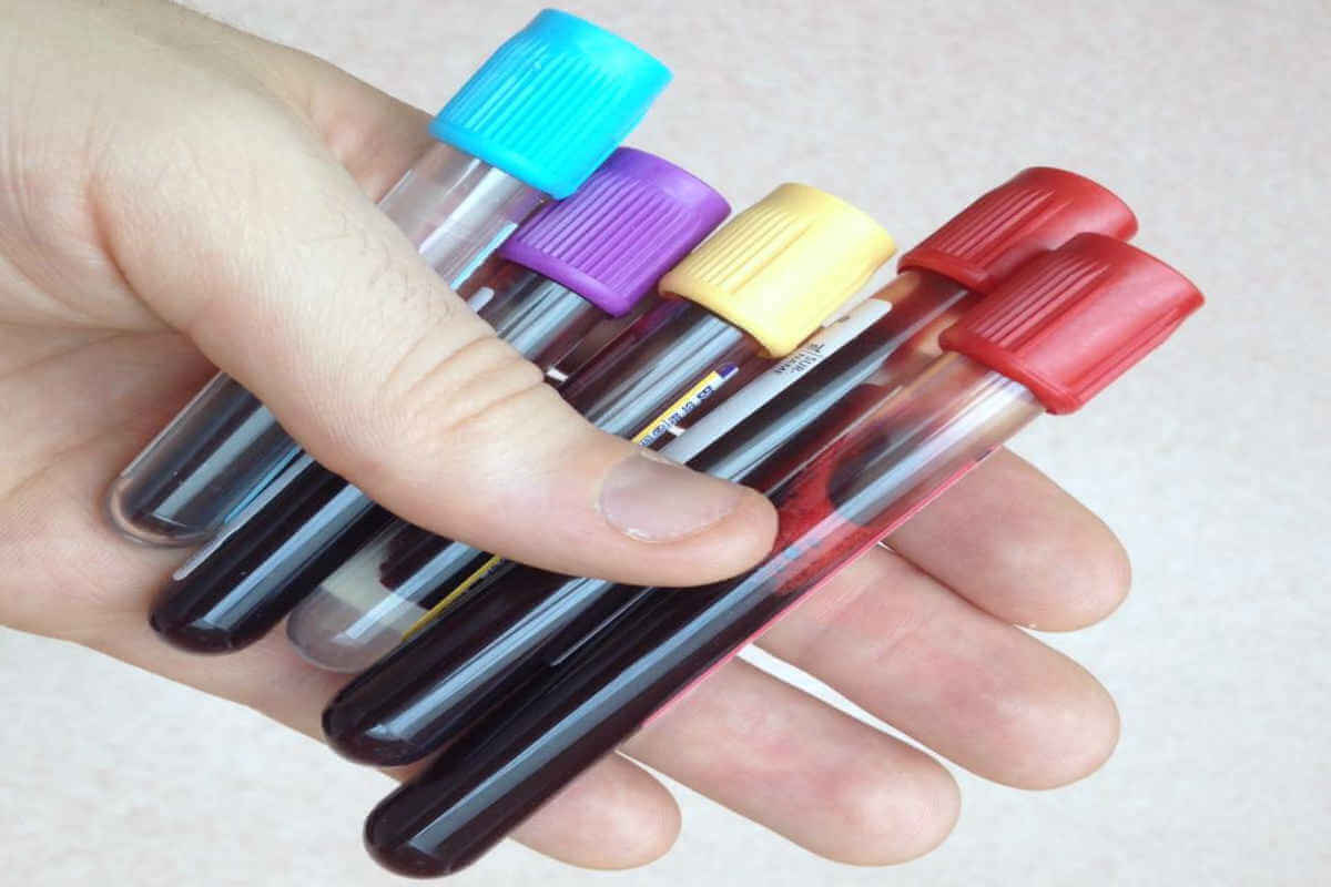 Blood tests for weight loss program