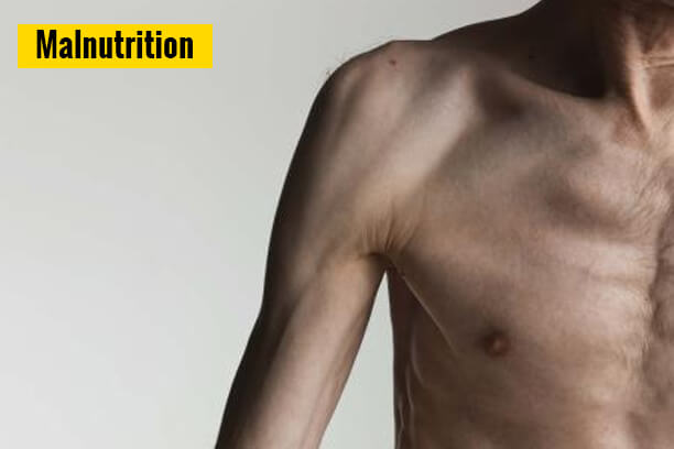 Liquid Diet! 7 Things to Know About Liquid Diet